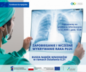 Działanie 6.21, typ 1 i 2 (RPZ Rak płuc) - zaproszenie na spotkanie informacyjne 12.02.2025 r.